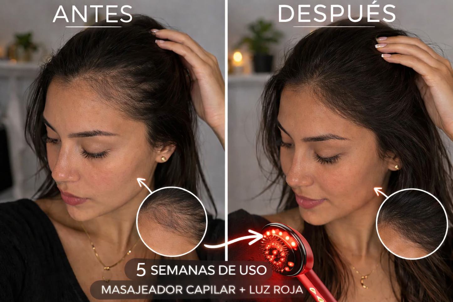 Masajeador Capilar Anticaída con Luz Roja