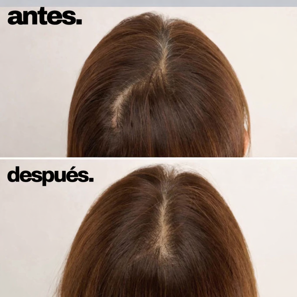 Masajeador Capilar Anticaída con Luz Roja